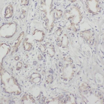 NECTIN3 Antibody