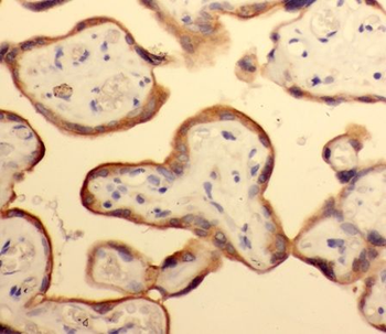 NECTIN4 Antibody