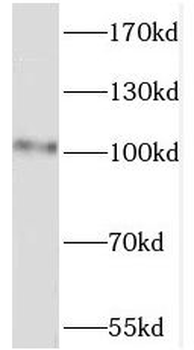 PWP2 Antibody