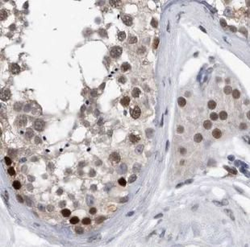 NR1I2 Antibody