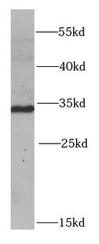 PYCR1 Antibody
