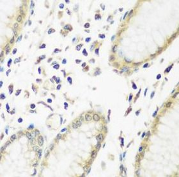 PYCR1 Antibody