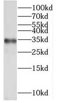 PYCR1 Antibody