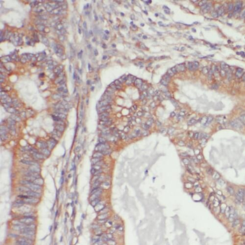 PYCR1 Antibody