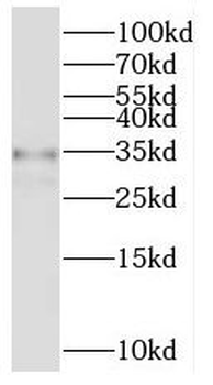 PYCR1 Antibody