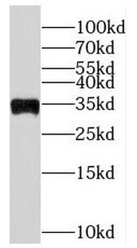 PYCR2 Antibody