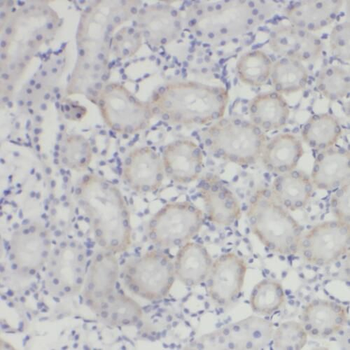 PYCR2 Antibody