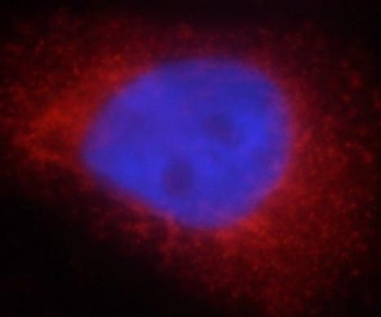 PYCR2 Antibody