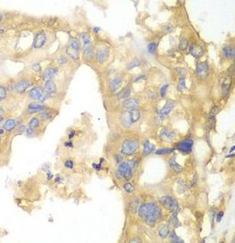 PYGB Antibody