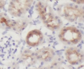 PYGL Antibody