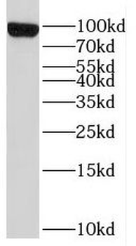 PYGL Rabbit Polyclonal Antibody