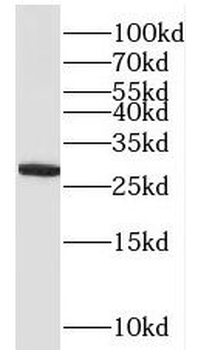 QDPR Antibody