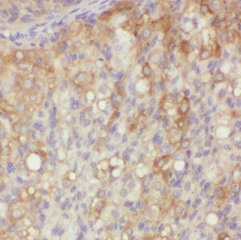 QDPR Antibody
