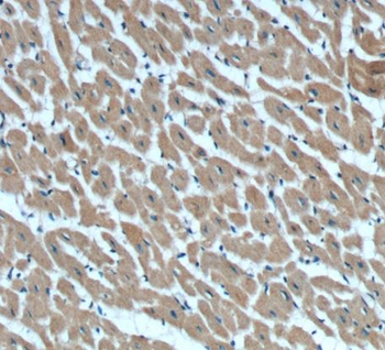 RAB11A Antibody