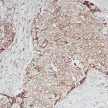 RAB11FIP1 Antibody