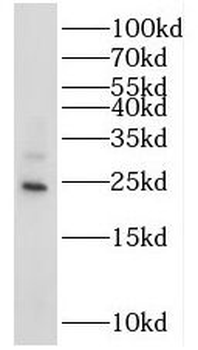 RAB14 Antibody