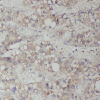 RAB14 Antibody
