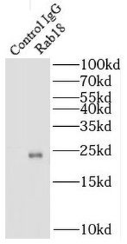 RAB18 Antibody