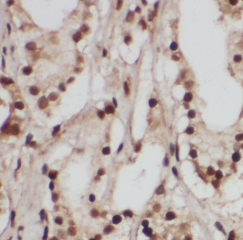 RAB18 Antibody