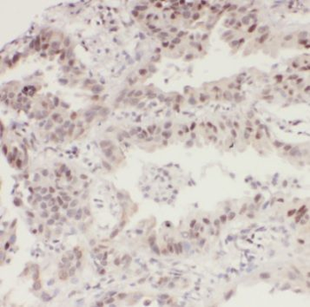RAB1A Antibody