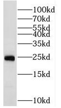 RAB2A Antibody