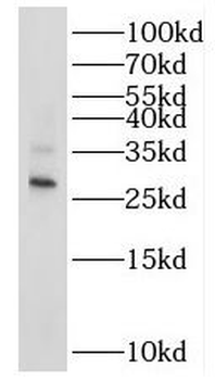 RAB20 Antibody
