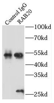 RAB20 Antibody