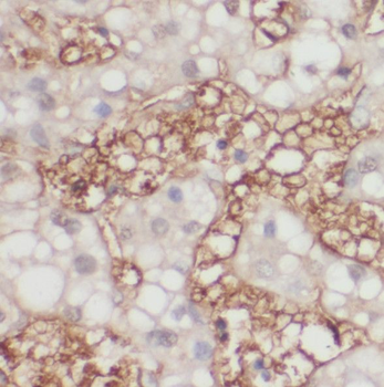 RAB23 Antibody