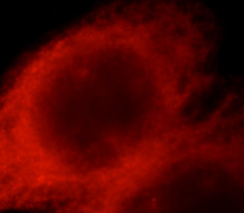 RAB27A Antibody