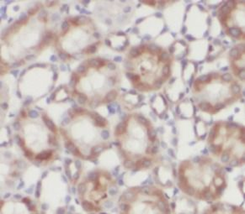 RAB27A Antibody