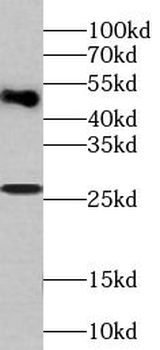 RAB27B Rabbit Polyclonal Antibody