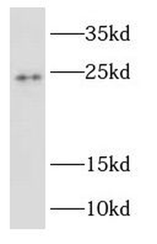 RAB2B Antibody