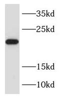 RAB31 Antibody