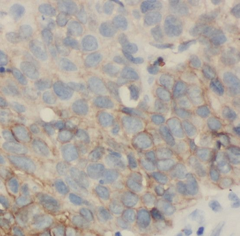 RAB32 Antibody
