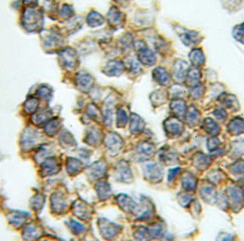RAB33A Antibody