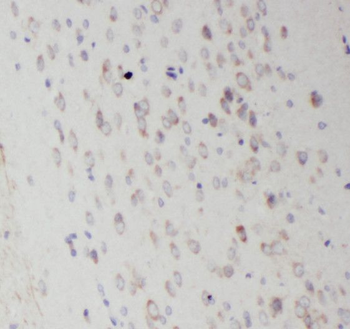 RAB35 Antibody