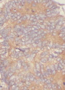 RAB3B Antibody