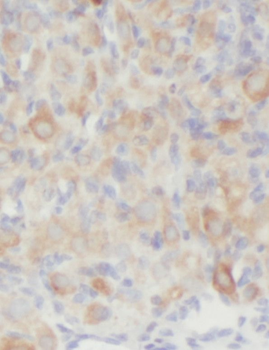 RAB3C Antibody
