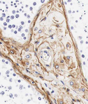 RAB3GAP1 Antibody