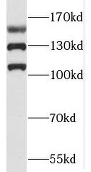 RAB3GAP2 Antibody