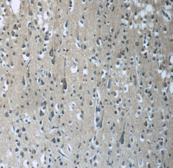 RAB3GAP2 Antibody