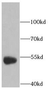 RAB3IP Antibody