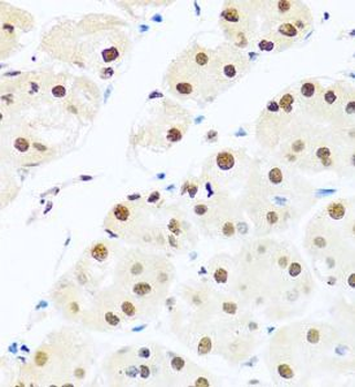 RAB3IP Antibody