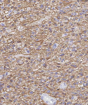 RAB40B Antibody