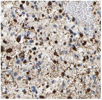 RAB5A Antibody