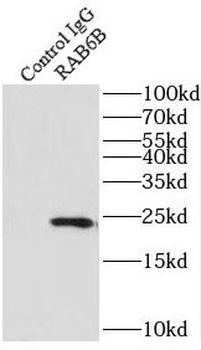RAB6B Antibody