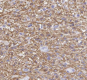 RAB6B Antibody
