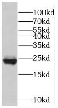 RAB7A Antibody