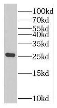 RAB7B Antibody