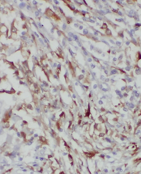 RAB8B Antibody
